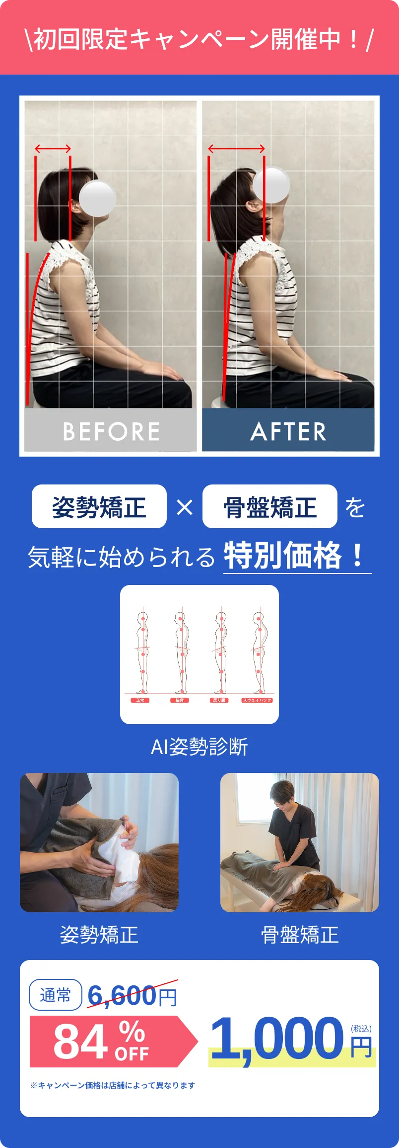 姿勢矯正、骨盤矯正がお得に受けられる特別価格
